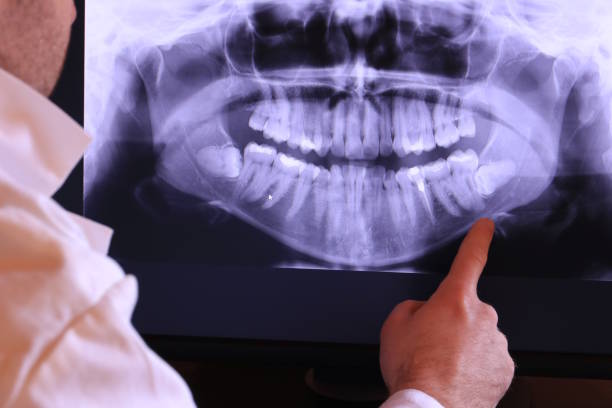 Best Emergency Dentist for Knocked-Out Tooth in Hamilton, GA