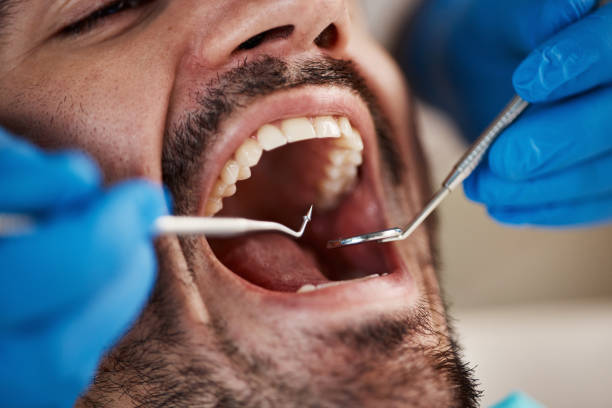 Best Emergency Dental Care for Abscessed Tooth in Hamilton, GA